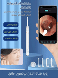 HD جهاز منظف الأذن الذكي مع كاميرا بدقة